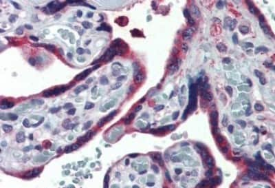 Immunohistochemistry-Paraffin: ERP44 Antibody [NBP3-14317] - Immunohistochemistry of formalin-fixed, paraffin-embedded human placenta after heat-induced antigen retrieval.